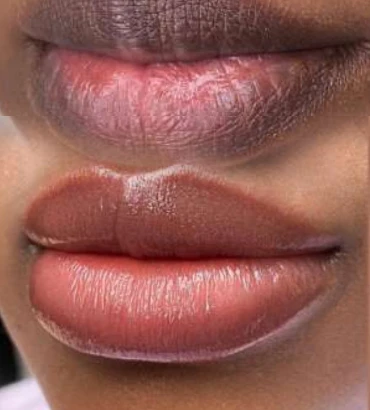 Two lip-color comparison photographs supplied by Permanent Makeup NYC