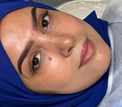 Full Face Natural Results 3
