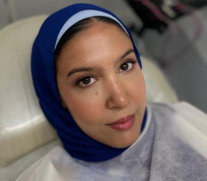 Full Face Natural Results